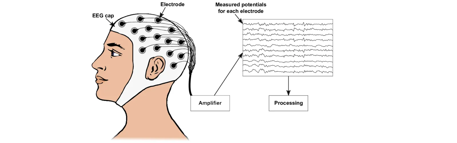 What is the Procedure of EEG?